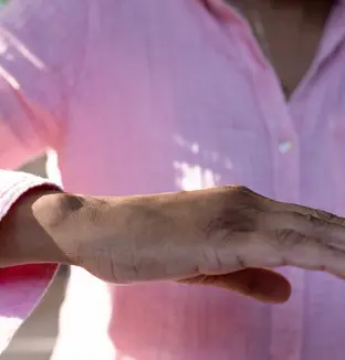 emeis_parkinson_evolution_petit